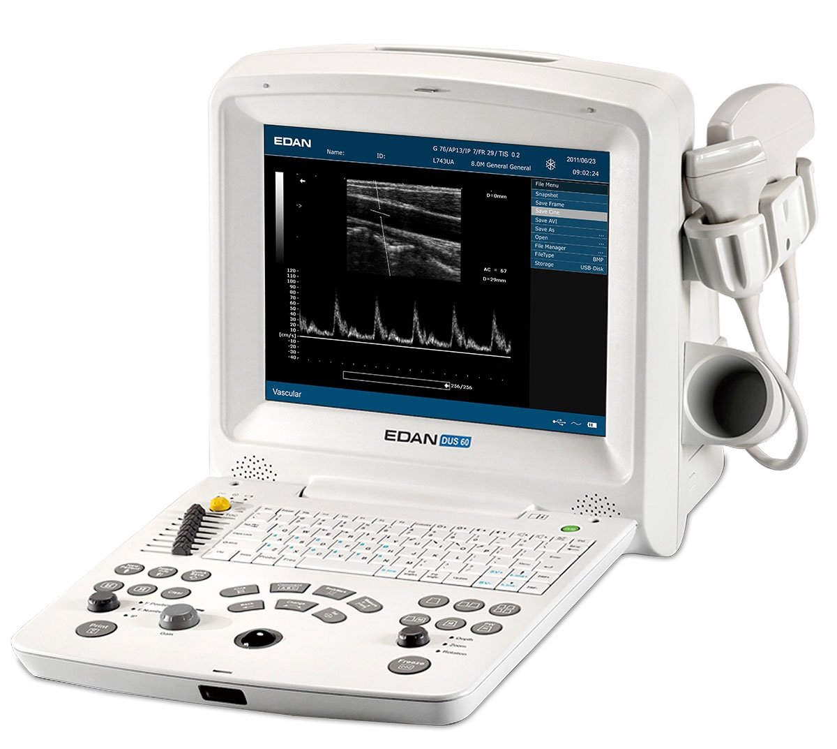 DUS 60 Ultrasound System