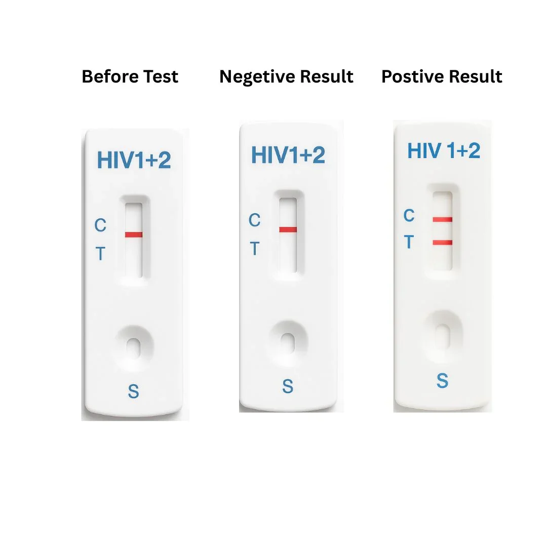 HIV Kit