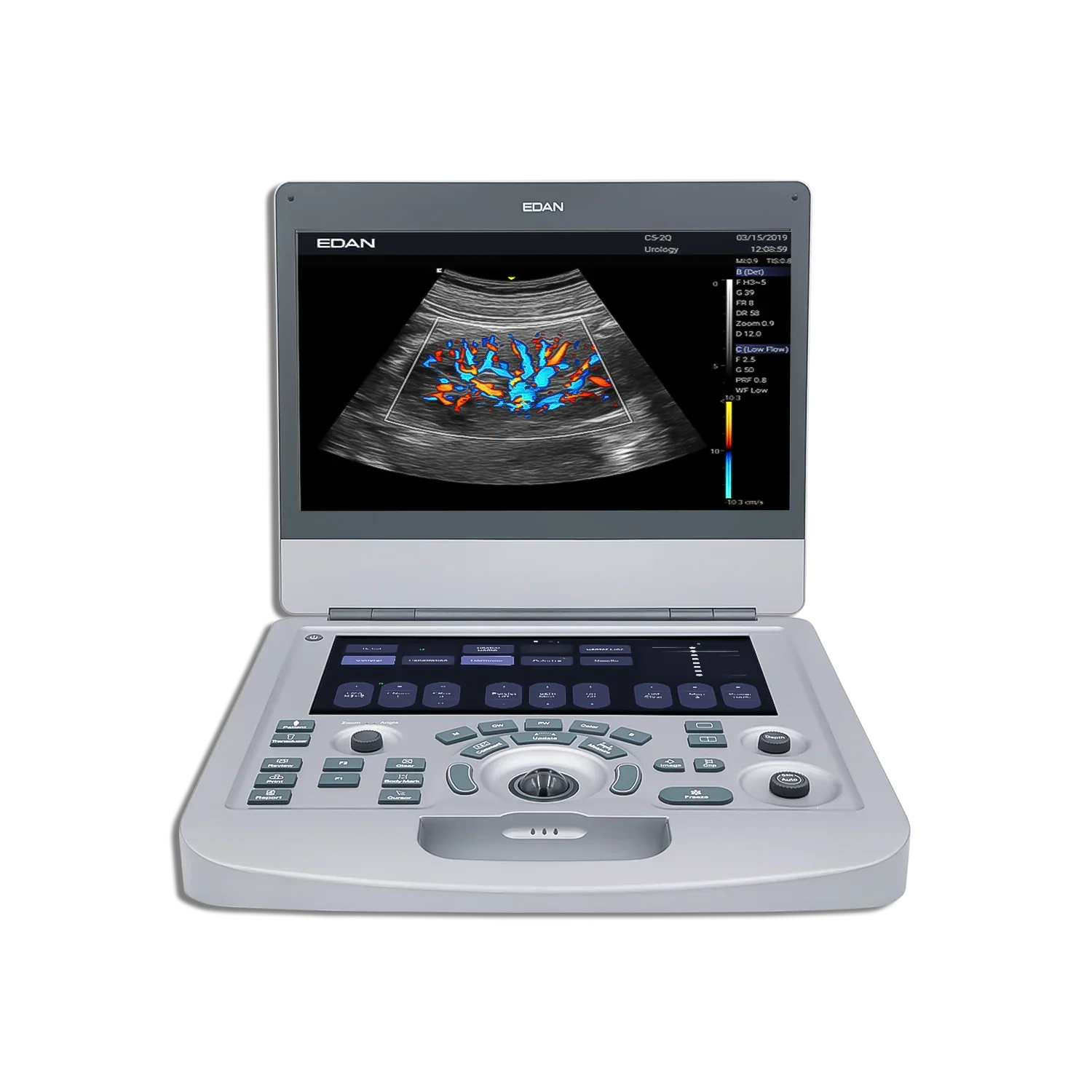 Ax3 EDAN Ultrasound System