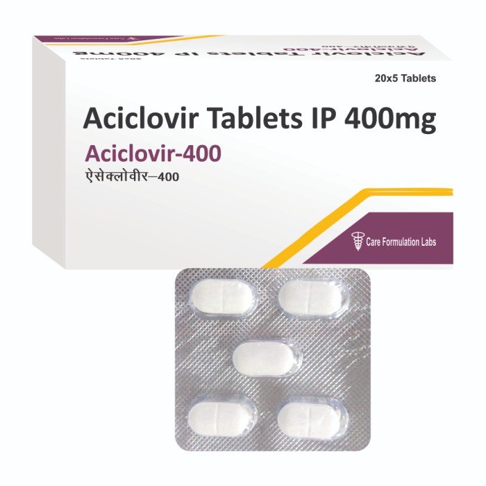 Cyclovir 400 (Aciclovir Tablets 400mg)