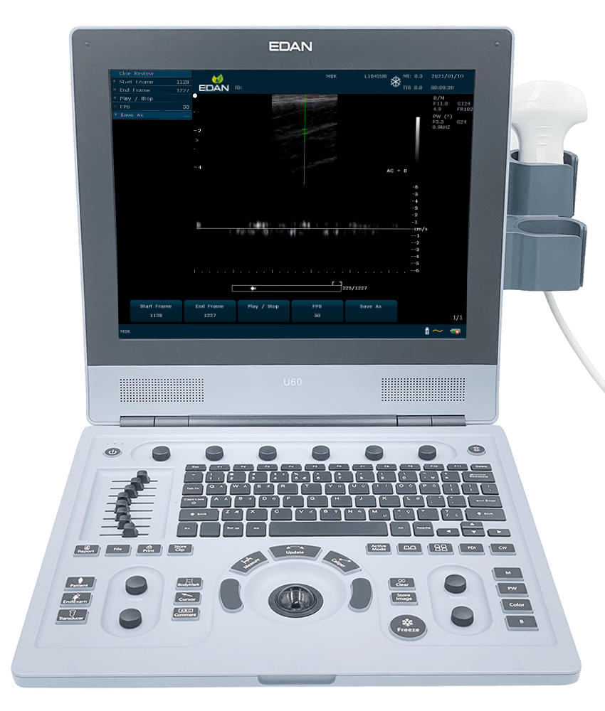 U60 Diagnostic Ultrasound System